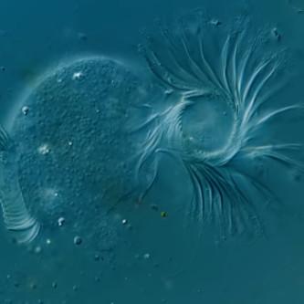 dying-ciliate-sm.jpg